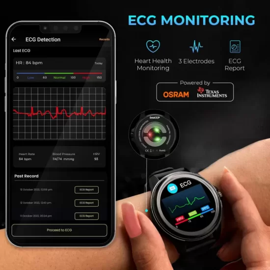 beatXP Exact, 1.32" Full HD Screen, Medical Grade ECG Smartwatch  (Charcoal black Strap, Free Size)