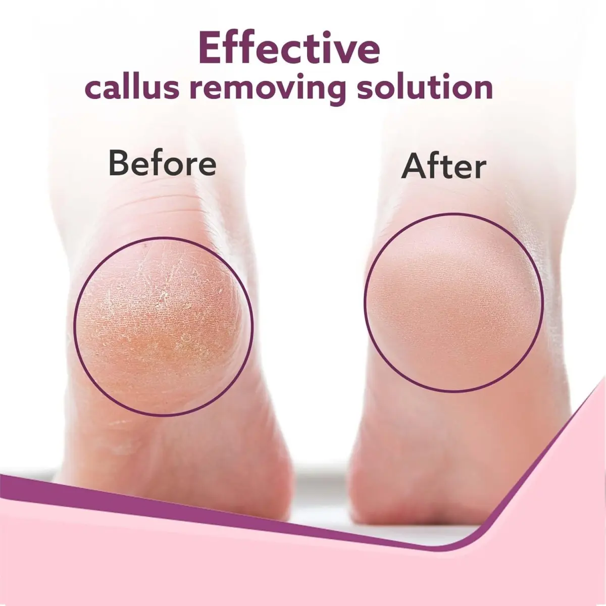 AGARO Callus Remover with 3-Interchangeable-Head-Rollers-Electronic-Foot-Scrubber