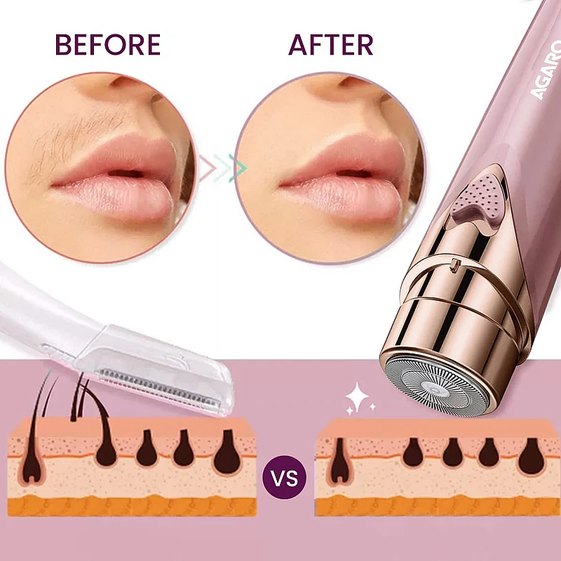 AGARO Facial Hair Remover MHR100 for Women, Electric Painless Hair Remover with 3D Floating Head Rose Gold AGARO Facial Hair Remover MHR100 for Women, Electric Painless Hair Remover with 3D Floating Head Rose Gold